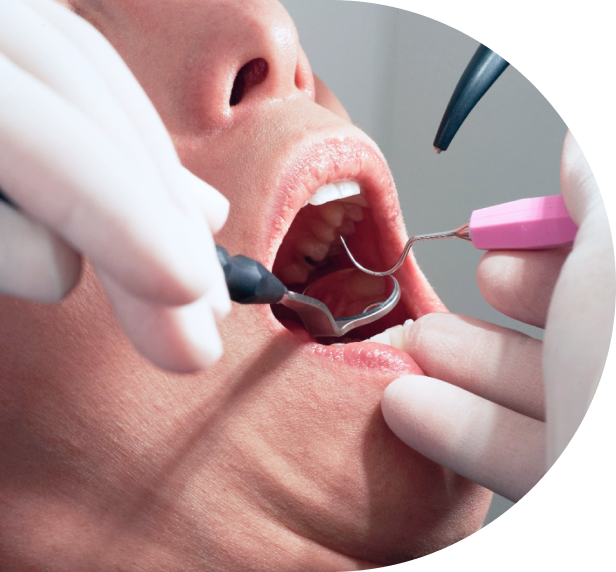 the dentist examines the patient's mouth