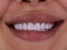 teeth